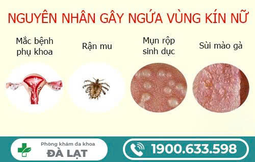 Hình ảnh minh họa